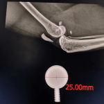 Radiografische Referenzkugel – 25 mm